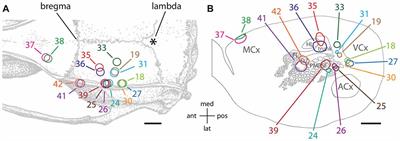 Long-Range, Border-Crossing, Horizontal Axon Radiations Are a Common Feature of Rat Neocortical Regions That Differ in Cytoarchitecture